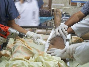 800px-Traction_placement